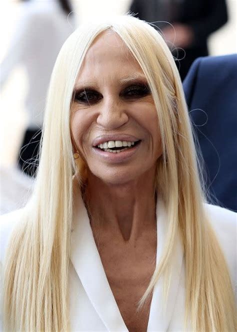 donatella versace face|donatella versace face what happened.